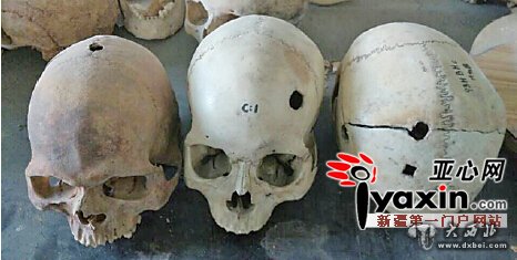 新疆考古发现60余个穿孔头骨 巫医治病、头骨崇拜？学术界观点不一